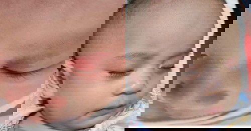 Red mark (angel kisses)