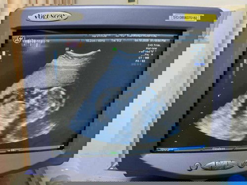 ถั่วเขียวเริ่มตัวโตแล้วคร้าบบบ