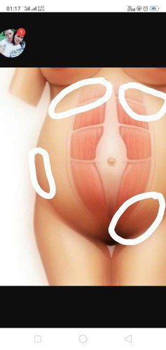 เวลานั่งเจ็บตรงที่วงไว้ค่ะ อันตรายไหมค่ะ