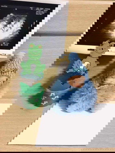 คิดถึงลูก ขอกำลังใจหน่อยค่ะแม่ๆ ตอนนี้จิตใจท้อแท้มากคิดถึงลูกจริงๆ