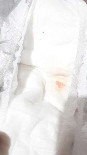 reddish sa diaper