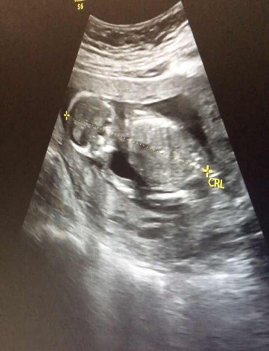 หาเพื่อนให้ลูกค่ะ 🥰