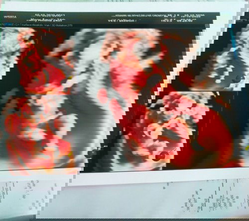 Usg 13 minggu.. MasyaAllah 😍