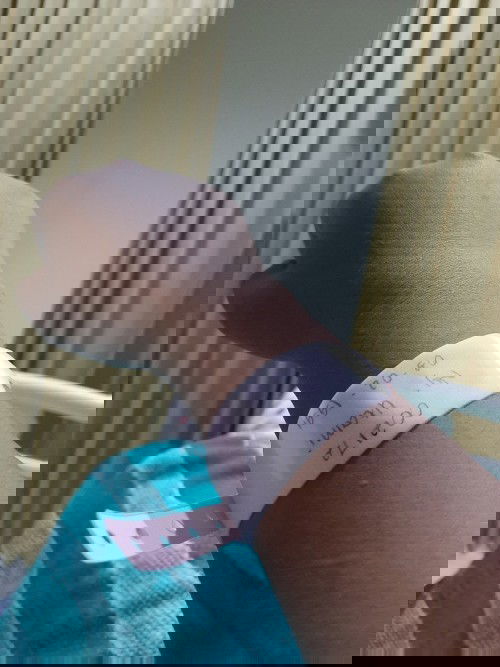 Air Ketuban Pecah Dini Sebelum Pembukaan