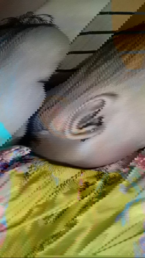 Tumbuh gigi, akhirnya sakit