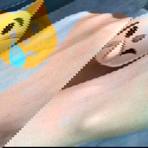 Uci uci atau ganglion