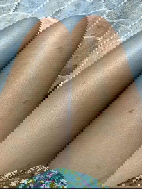 Hi mommy, anyone hv problem with skin bcos bites bugs? I’m pregnant 22 weeks. Is it allow take a Medicine? Itchy :(