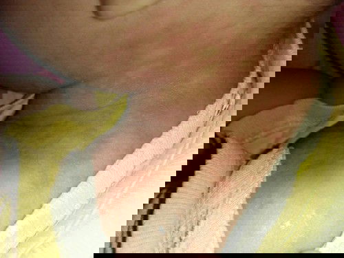 Ini kenapa ya bun? Yg pernah ngalamin yuk shareing