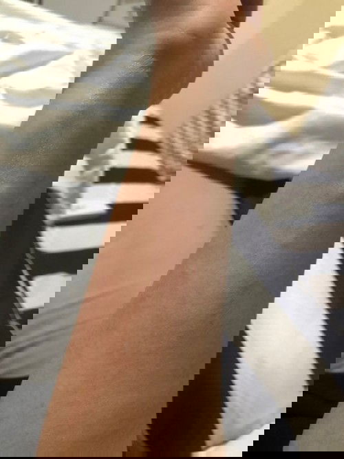 Gatal kulit di usia hamil 32w