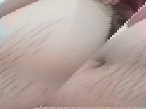 ท้องแตกทำยังไงดีคะ