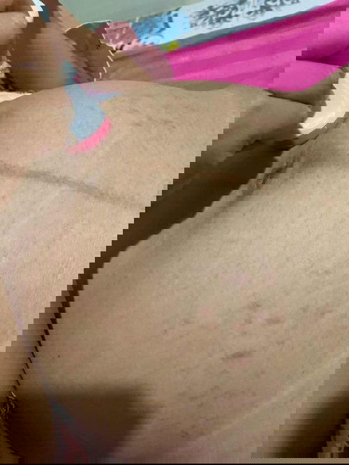 ท้องลายแล้วจร้า