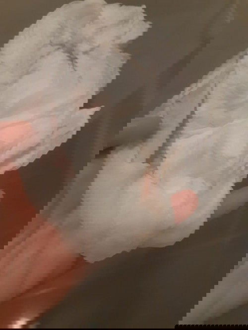 เลือดออกตอนเช้าหลังปัสสาวะ จะเป็นอะไรไม๊คะ