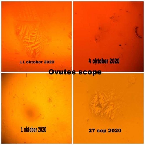 Ada yg pengalaman pakai ovutes scope