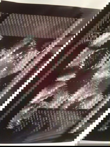 Gender janin bisa berubahkah?