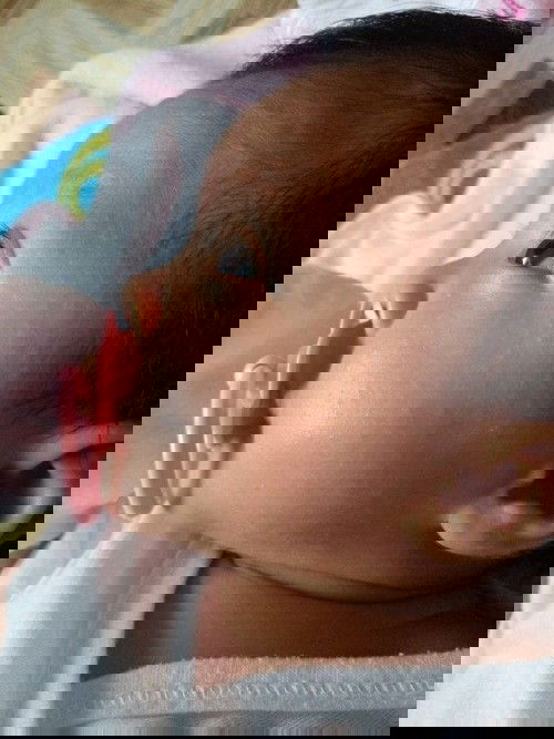 Hello mommy normal lang poba yung nasa muka ni baby? 1month & 25days napo sya. First time mommy po😊