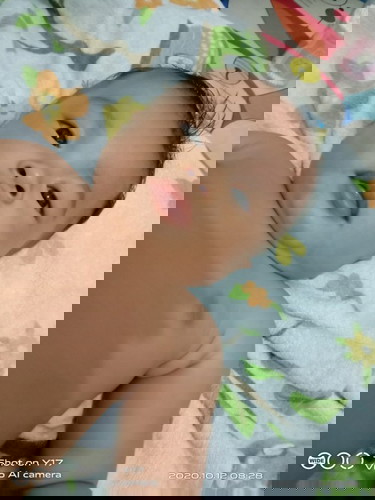 Solusinya dong apa obat/salep yg bagus buat ngilangin putih2 d pipinya....???? Kata orang bekas asi.