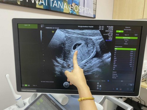 ท้องแรกค่ะ😊คุณแม่มือใหม่