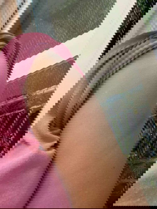 Chích ngừa uốn ván.