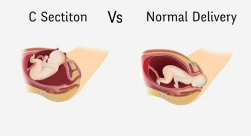 Itry inormal or Cs na?