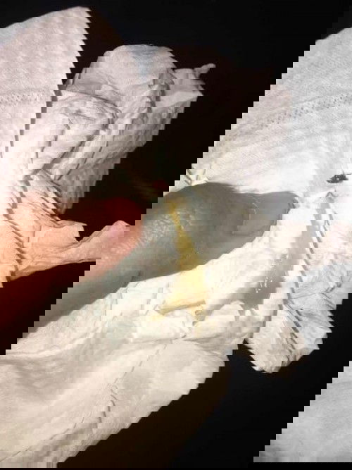 เมื่อวานโดนตรวจปากมดลูก  แต่ยังไม่เปิด