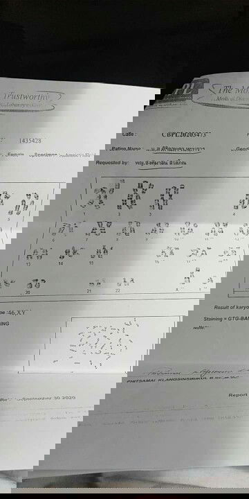 ฟังผลเจาะน้ำคร่ำ