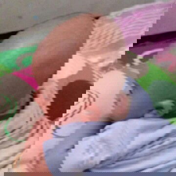 bayi 2 bulan kepala gepeng