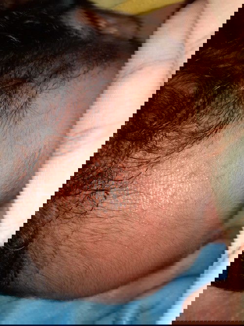 Bintik merah di wajah