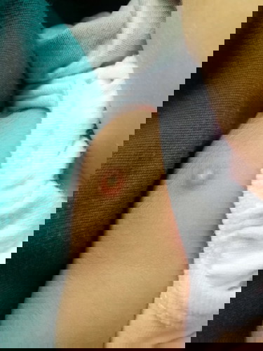 Bakuna(BCG & HEPA) 
1M 1 Week old baby