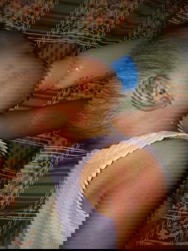 alergi
