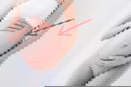 เจ็บท้องเจ็บท้องด้านขวา