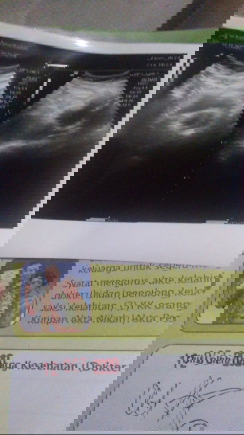 Hamil 8week tapi keguguran