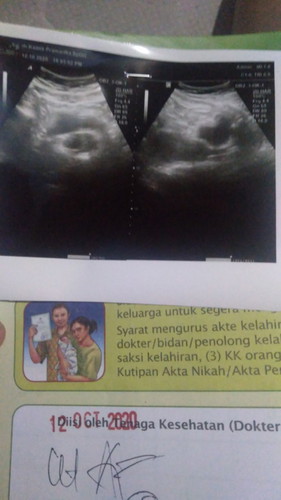 Hamil 8week tapi keguguran
