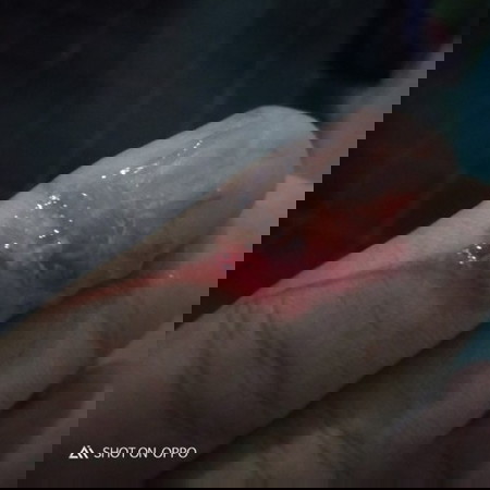 keptihan campur darah