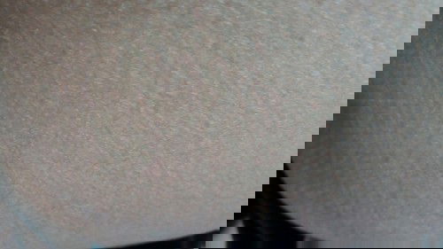 Kulit kering dan gatal