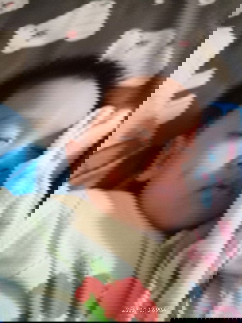 น้องโดนยุงกัด