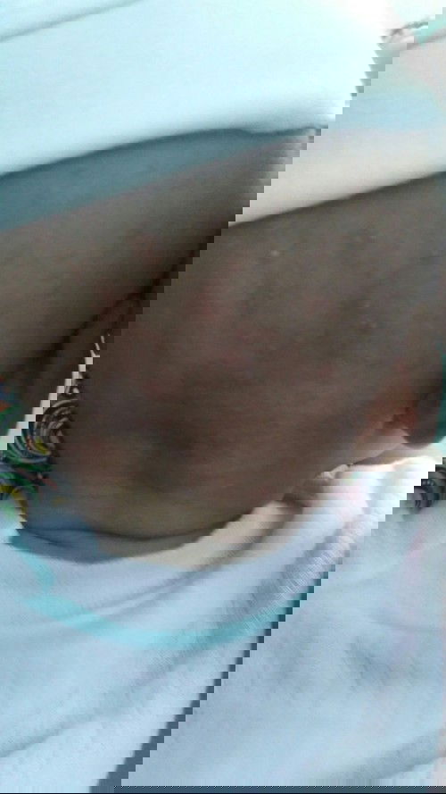 biang keringat apa bukan bun?