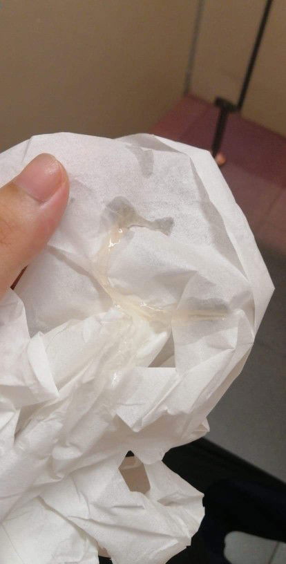 นี้ใช่มูกที่ใกล้คลอดมั้ยค่ะ