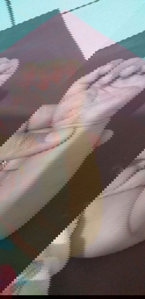 anak usia 2 bulan badan bintik2