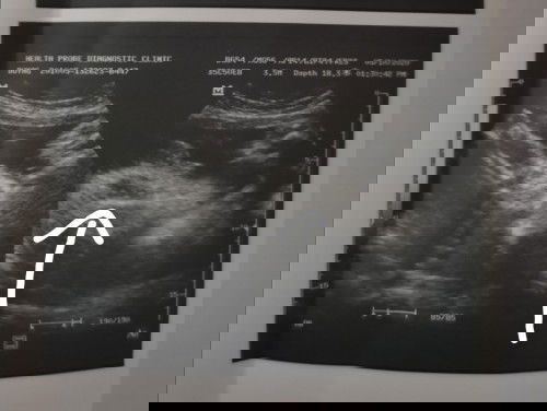 Keps o betlog 🤔🤔🤔