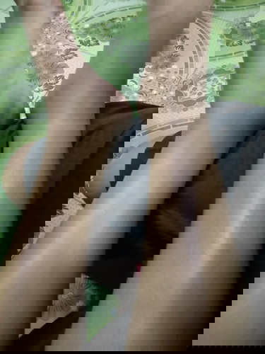 เท้าบวมผิดปกติไหม