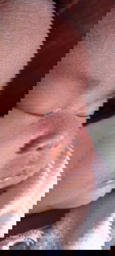 Kulit bayi bintik2 merah