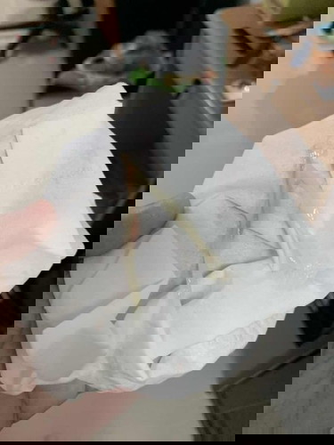 ใช่มูกเลือดมั้ย