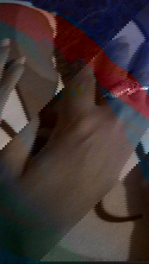 Sakit di bagian sela ibu jari