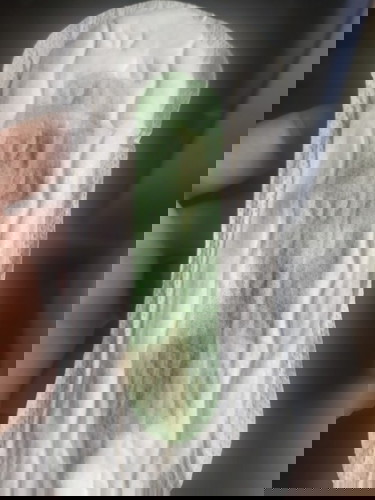 is it normal?