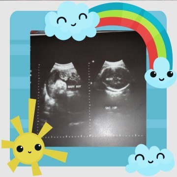 Pround mom of two baby boy 👶🧒