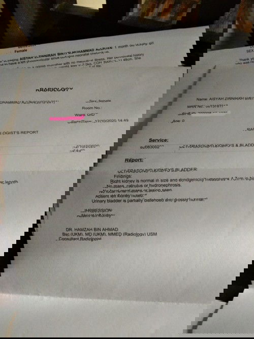 buah pinggang tunggal