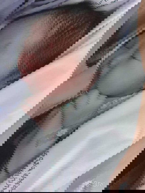 คลอดแล้วนะคะ 🥰