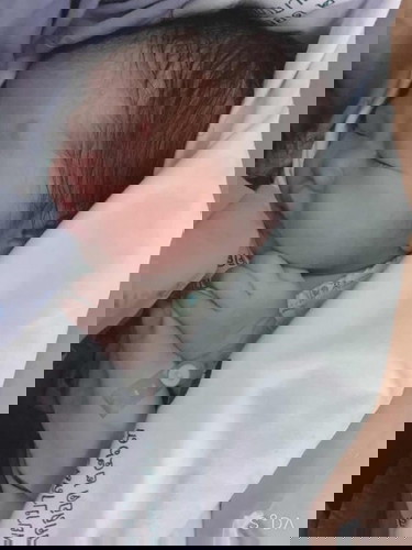 คลอดแล้วนะคะ 🥰