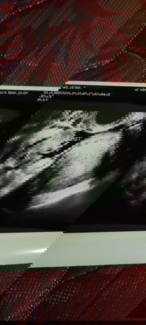 Hamil 4w. Sudah USG trans-V tapi kata dokter tidak kelihatan, kantong pun tidak kelihatan