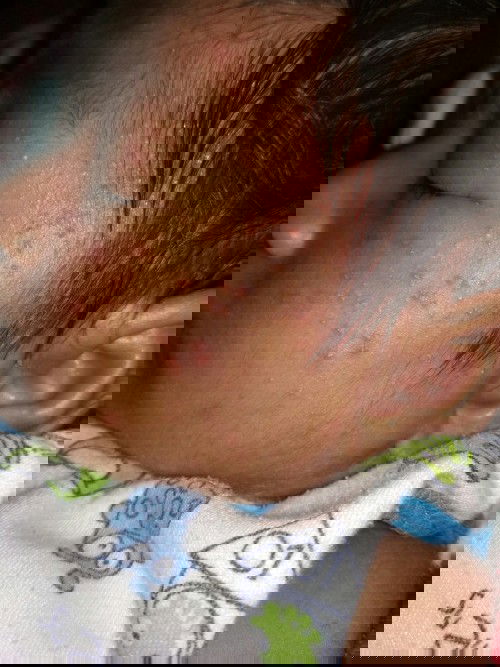 muka seperti biang keringat.